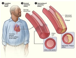 What are Lipids - Cardiology What are Lipids - Cardiology